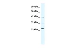 Antibody used in WB on Human Daudi cells at 0.2-1 ug/ml.