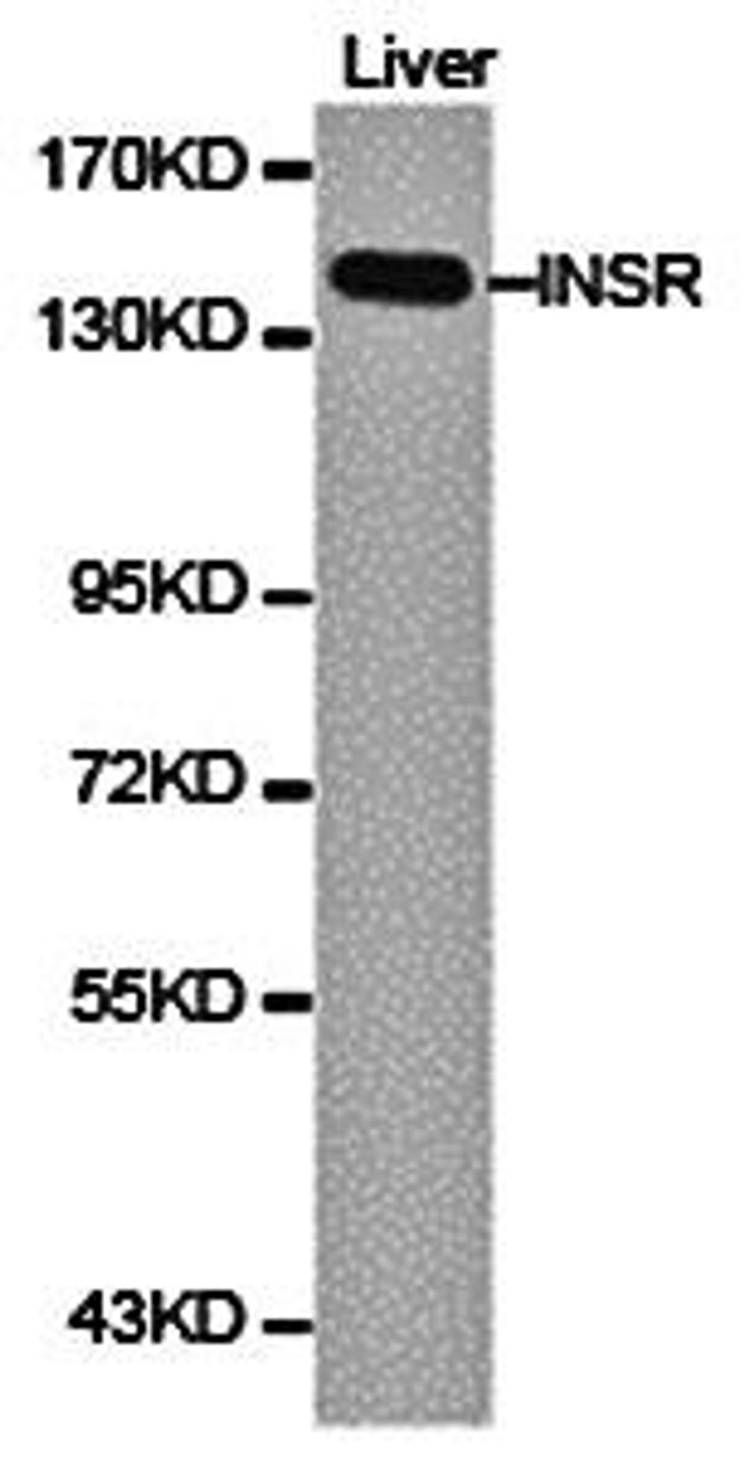 Western blot analysis of extracts of liver cell line lysate using Insulin Receptor beta antibody