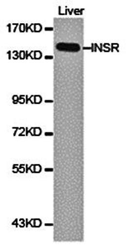 Western blot analysis of extracts of liver cell line lysate using Insulin Receptor beta antibody