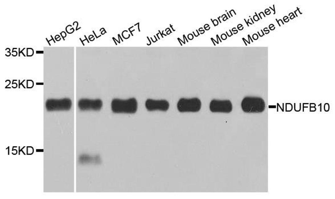 Western blot analysis of extracts of various cell lines using NDUFB10 antibody