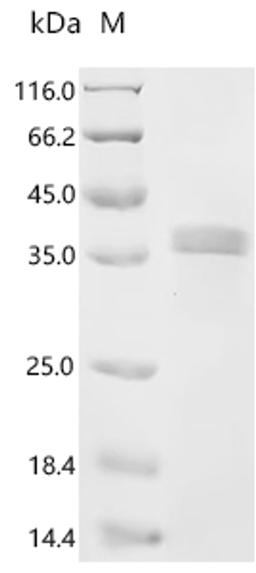 (Tris-Glycine gel) Discontinuous SDS-PAGE (reduced) with 5% enrichment gel and 15% separation gel.