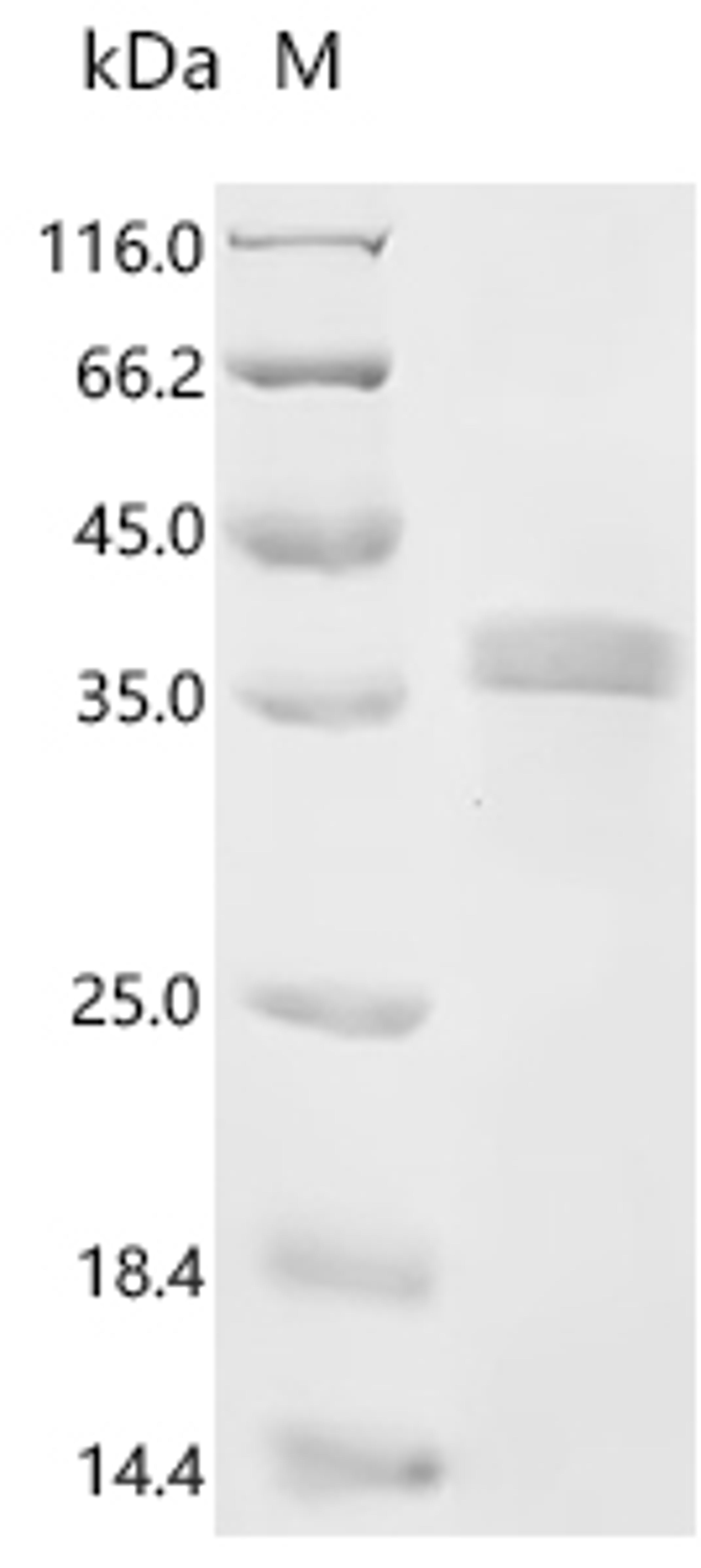 (Tris-Glycine gel) Discontinuous SDS-PAGE (reduced) with 5% enrichment gel and 15% separation gel.
