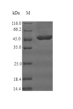 (Tris-Glycine gel) Discontinuous SDS-PAGE (reduced) with 5% enrichment gel and 15% separation gel.