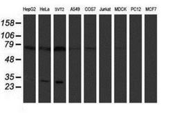 Western Blot: Pallidin Antibody (1H9) [NBP2-01763] Analysis of extracts (35ug) from 9 different cell lines by using anti-Pallidin monoclonal antibody.