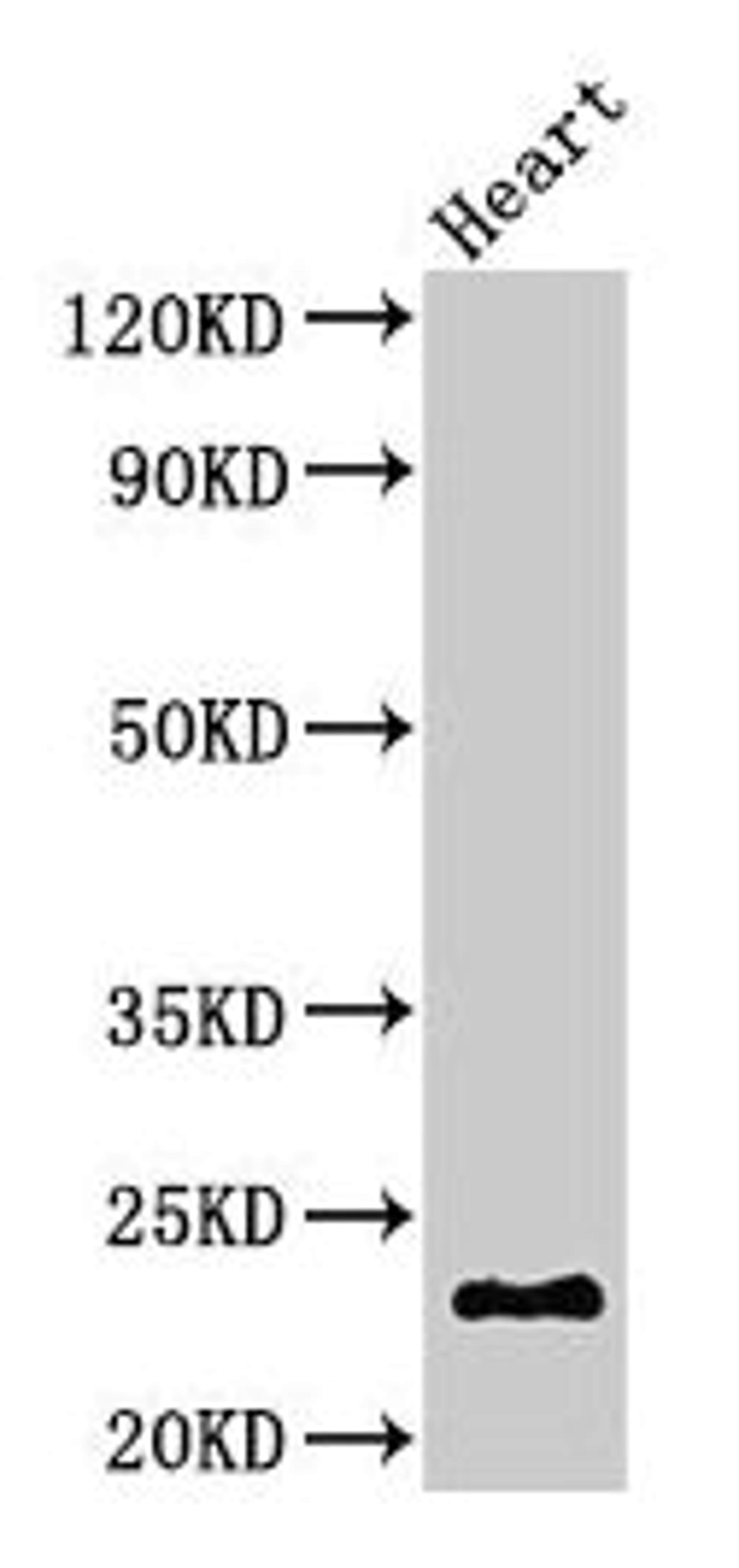 Western Blot. Positive WB detected in: Mouse heart tissue. All lanes: CRYBA4 antibody at 3µg/ml. Secondary. Goat polyclonal to rabbit IgG at 1/50000 dilution. Predicted band size: 23 kDa. Observed band size: 23 kDa
