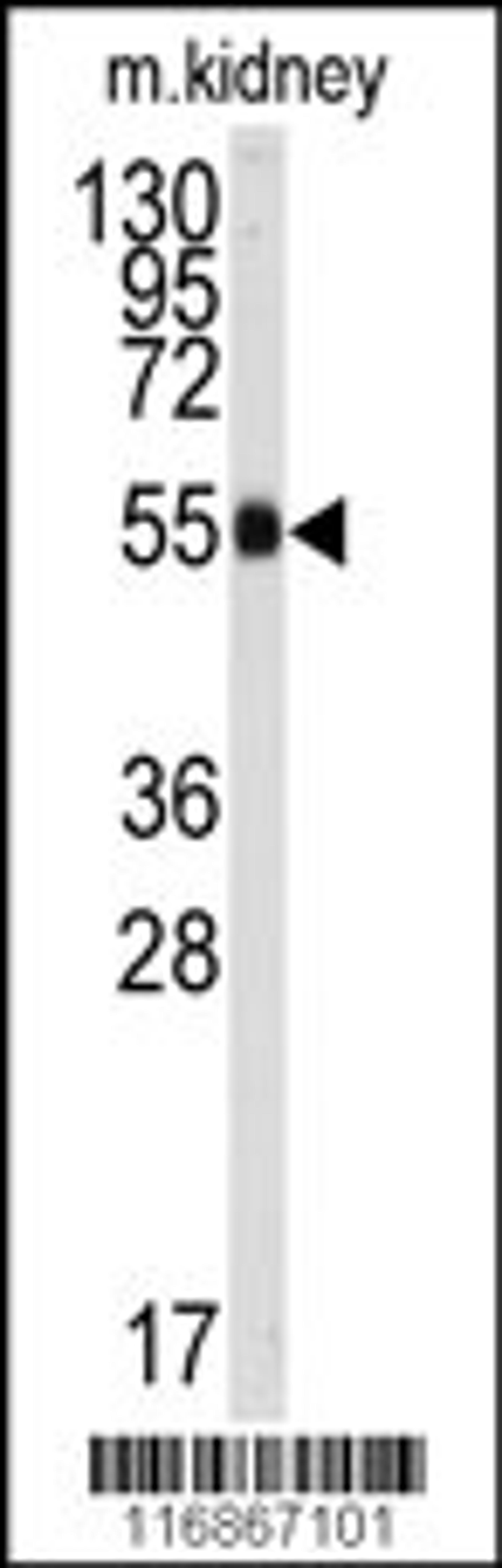 Western blot analysis of anti-ALDH9A1 Antibody in mouse kidney tissue lysates (35ug/lane).