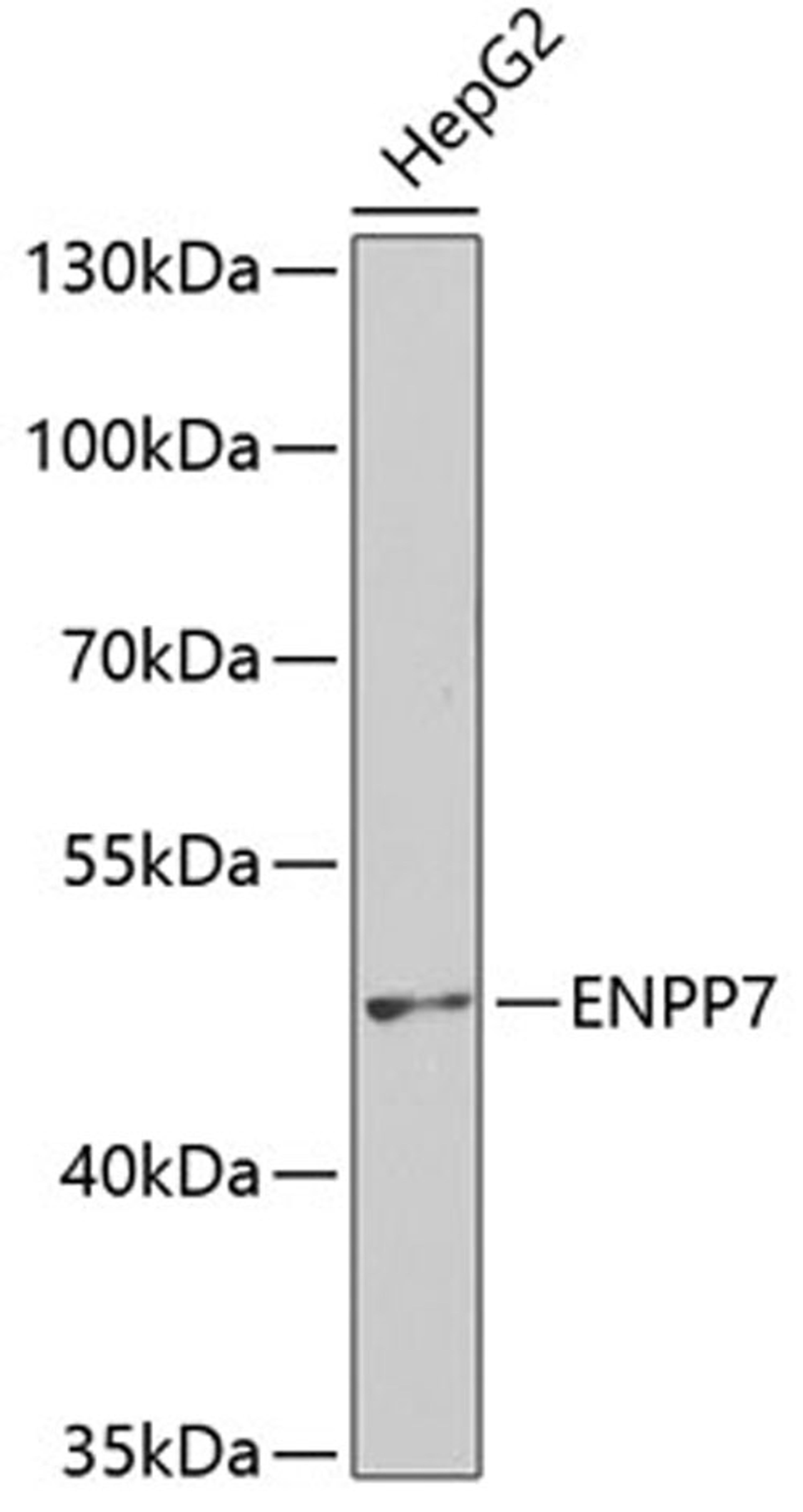 Western blot - ENPP7 antibody (A2912)