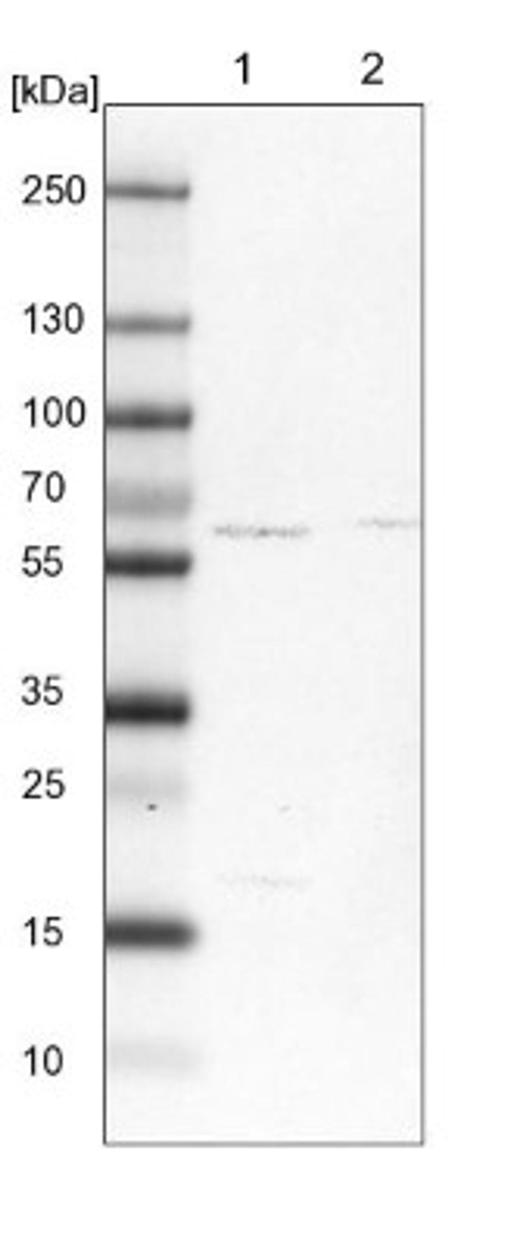 Western Blot: SUR-8 Antibody [NBP1-87831] - Lane 1: NIH-3T3 cell lysate (Mouse embryonic fibroblast cells)<br/>Lane 2: NBT-II cell lysate (Rat Wistar bladder tumour cells)