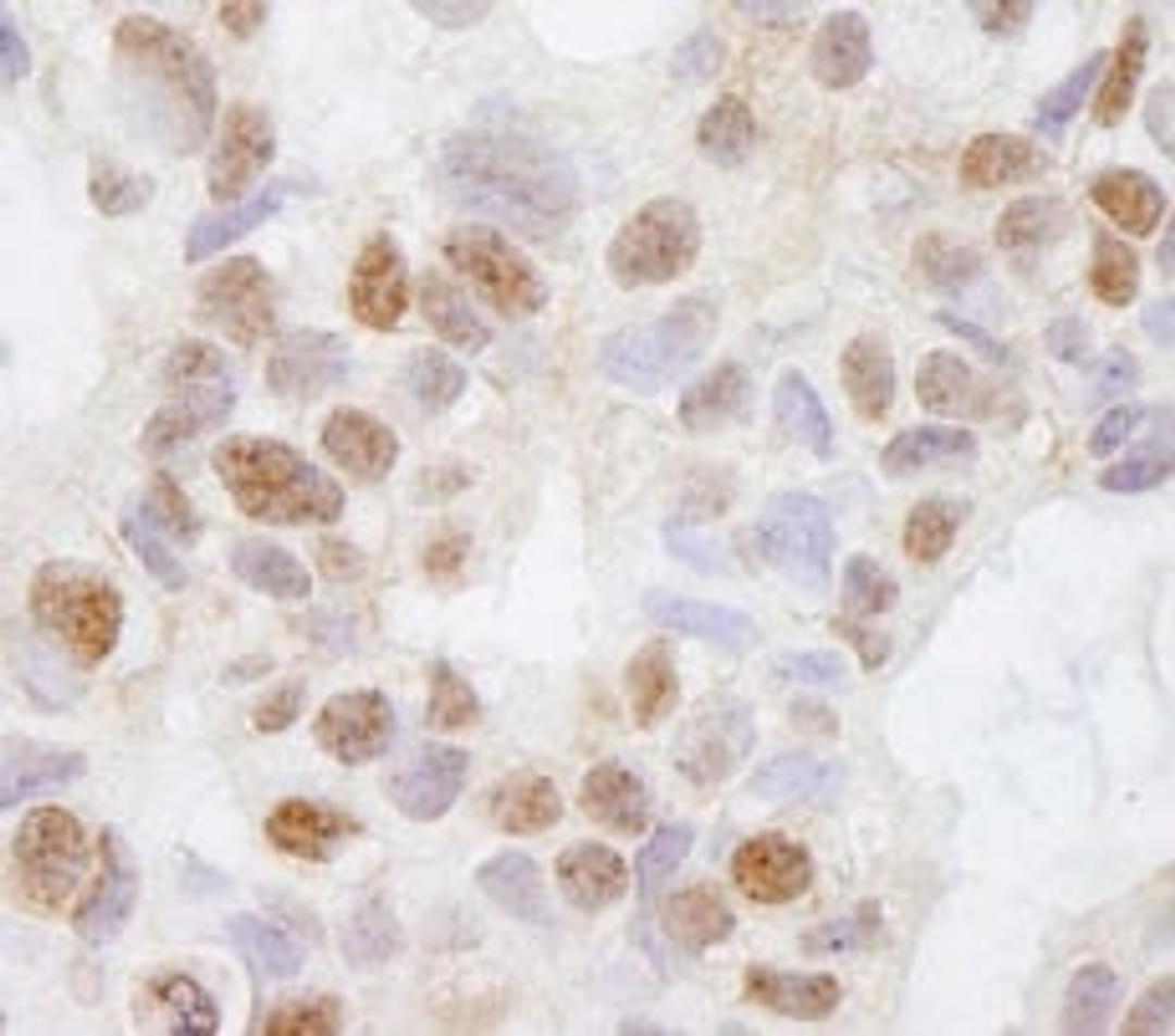 Detection of human DHX38 by immunohistochemistry.