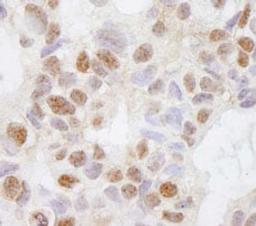 Detection of human DHX38 by immunohistochemistry.