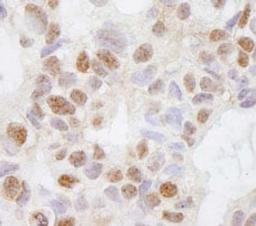 Detection of human DHX38 by immunohistochemistry.