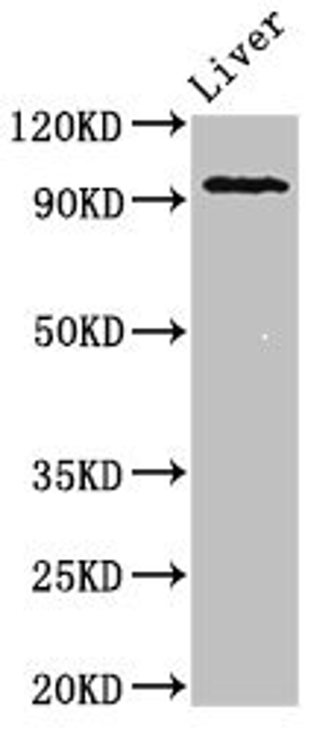 Western Blot. Positive WB detected in: Mouse liver tissue. All lanes: KDM1A antibody at 2µg/ml. Secondary. Goat polyclonal to rabbit IgG at 1/50000 dilution. Predicted band size: 93, 96 kDa. Observed band size: 93 kDa