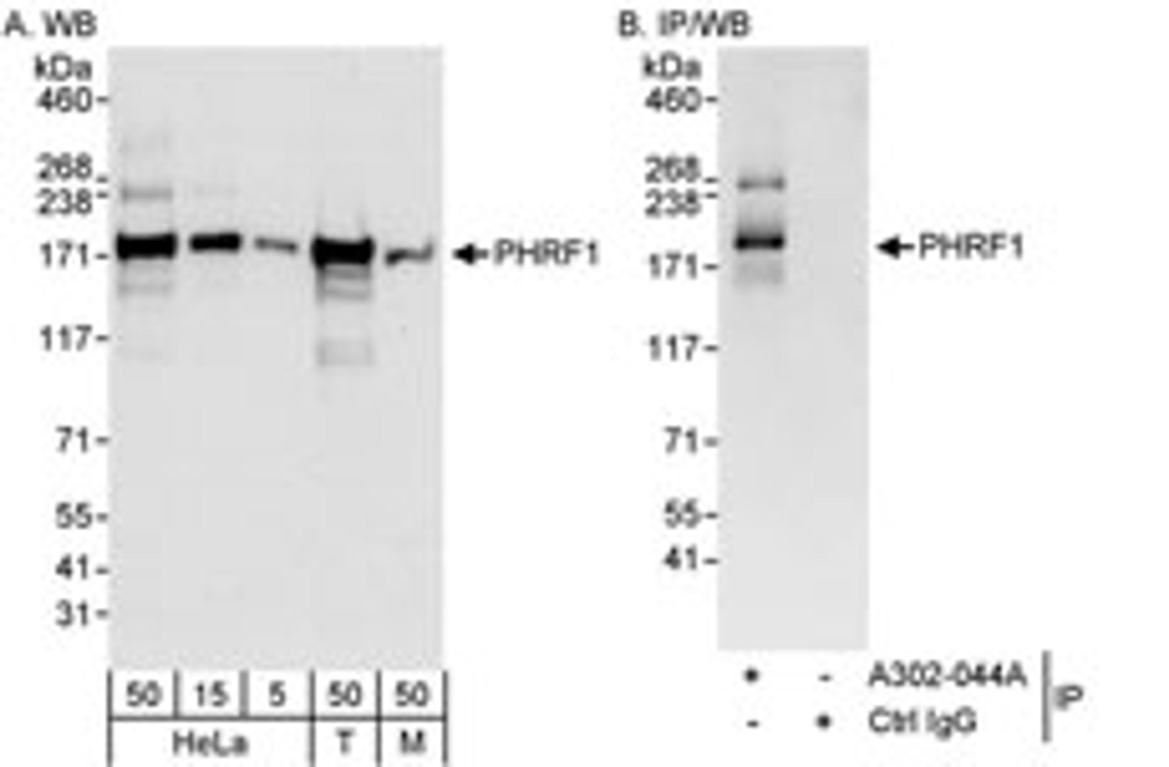 Detection of human and mouse PHRF1 by western blot (h&m) and immunoprecipitation (h).