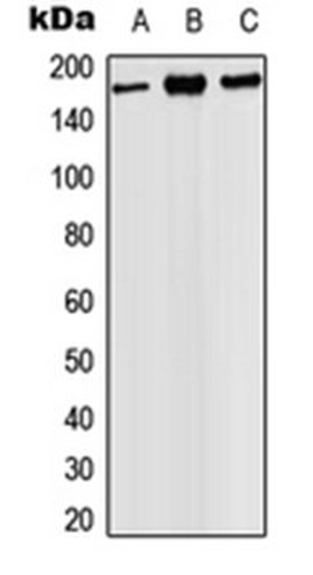 Western blot analysis of HEK293T (Lane 1), SP2/0 (Lane 2), PC12 (Lane 3) whole cell lysates using PHLPP1 antibody