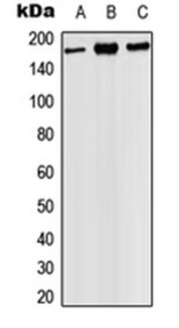 Western blot analysis of HEK293T (Lane 1), SP2/0 (Lane 2), PC12 (Lane 3) whole cell lysates using PHLPP1 antibody