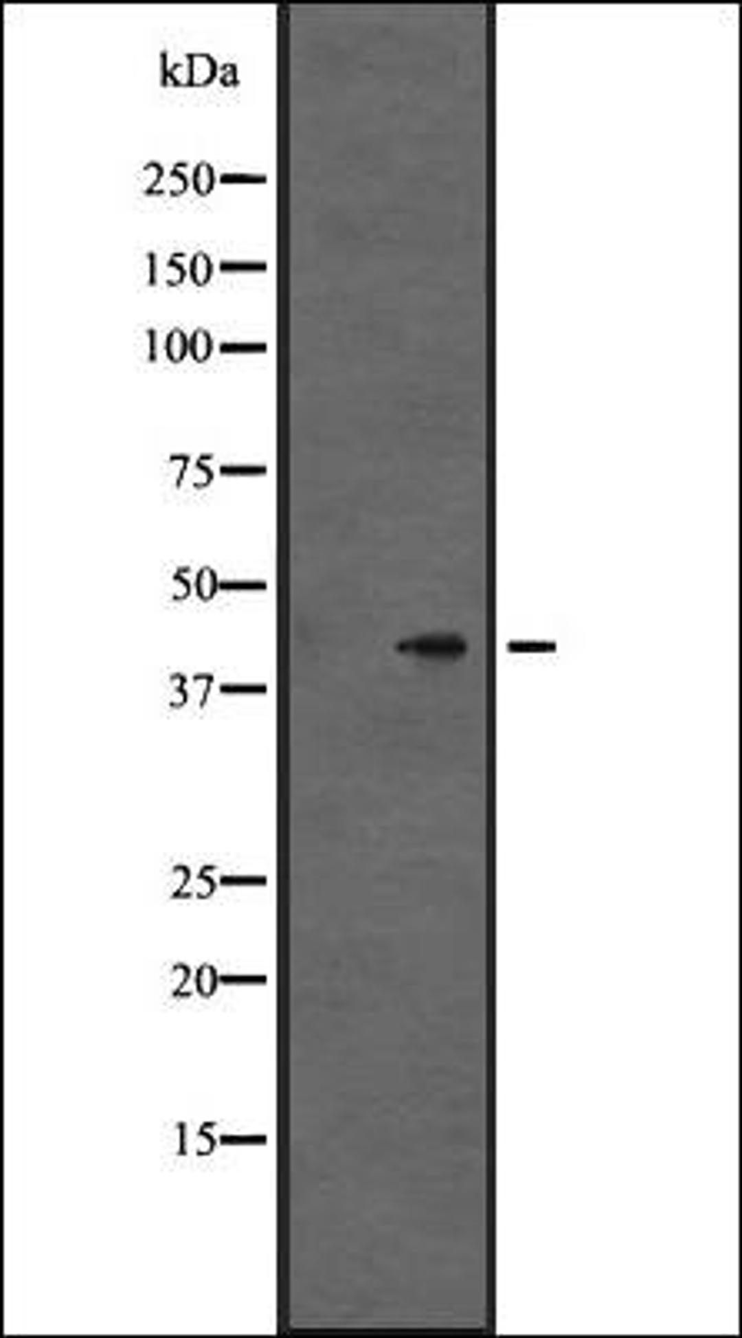 Western blot analysis of Hela cell lysate using GPR86/GPR94 antibody