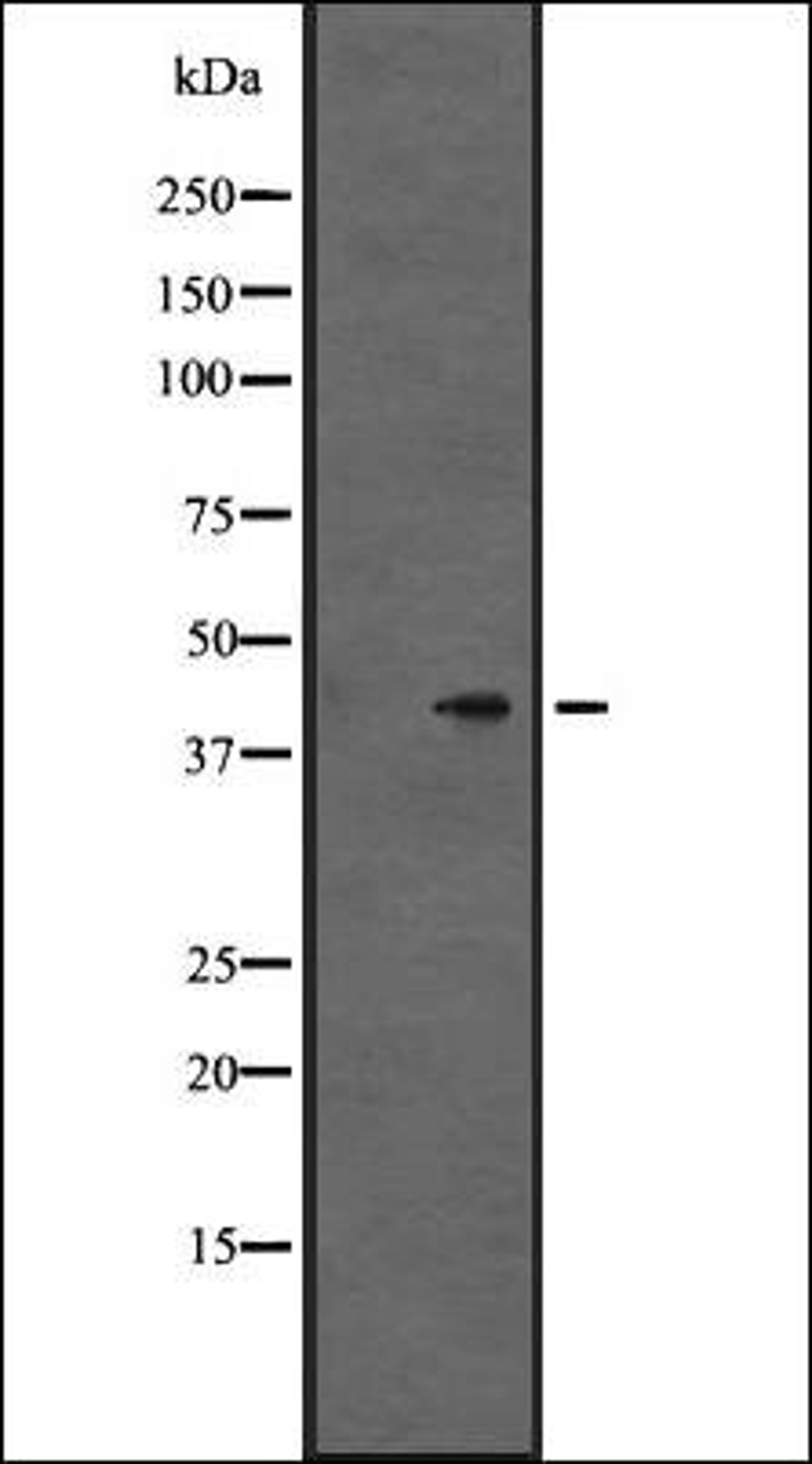 Western blot analysis of Hela cell lysate using GPR86/GPR94 antibody