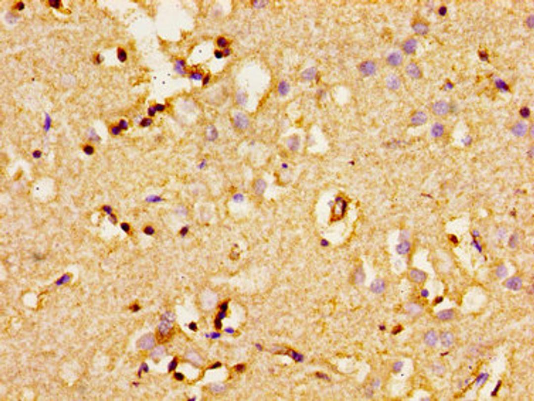 Immunohistochemistry of paraffin-embedded human brain tissue using CSB-PA001344LA01HU at dilution of 1:100