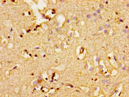 Immunohistochemistry of paraffin-embedded human brain tissue using CSB-PA001344LA01HU at dilution of 1:100