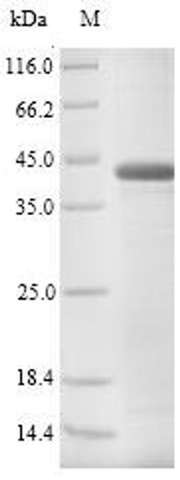 (Tris-Glycine gel) Discontinuous SDS-PAGE (reduced) with 5% enrichment gel and 15% separation gel.