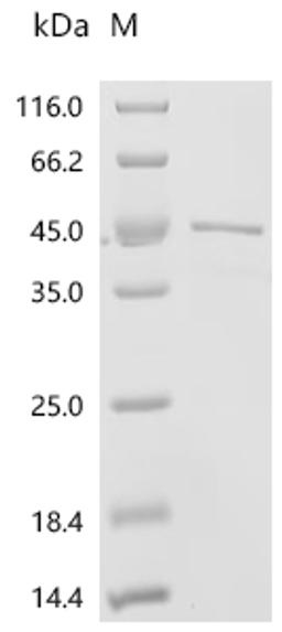 (Tris-Glycine gel) Discontinuous SDS-PAGE (reduced) with 5% enrichment gel and 15% separation gel.