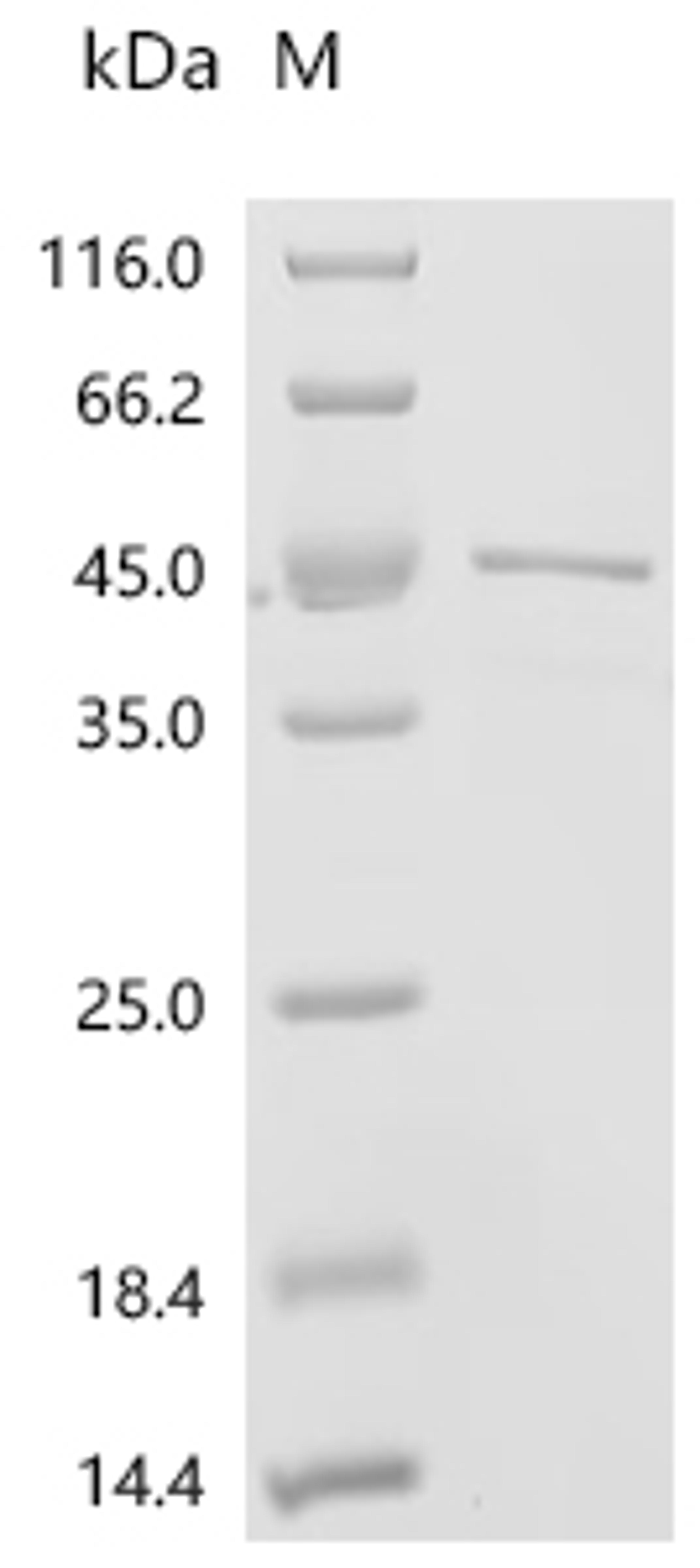 (Tris-Glycine gel) Discontinuous SDS-PAGE (reduced) with 5% enrichment gel and 15% separation gel.