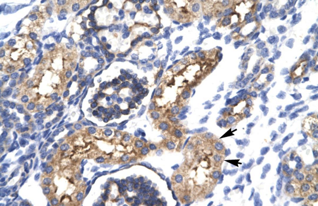 Antibody used in IHC on Human kidney lysate.