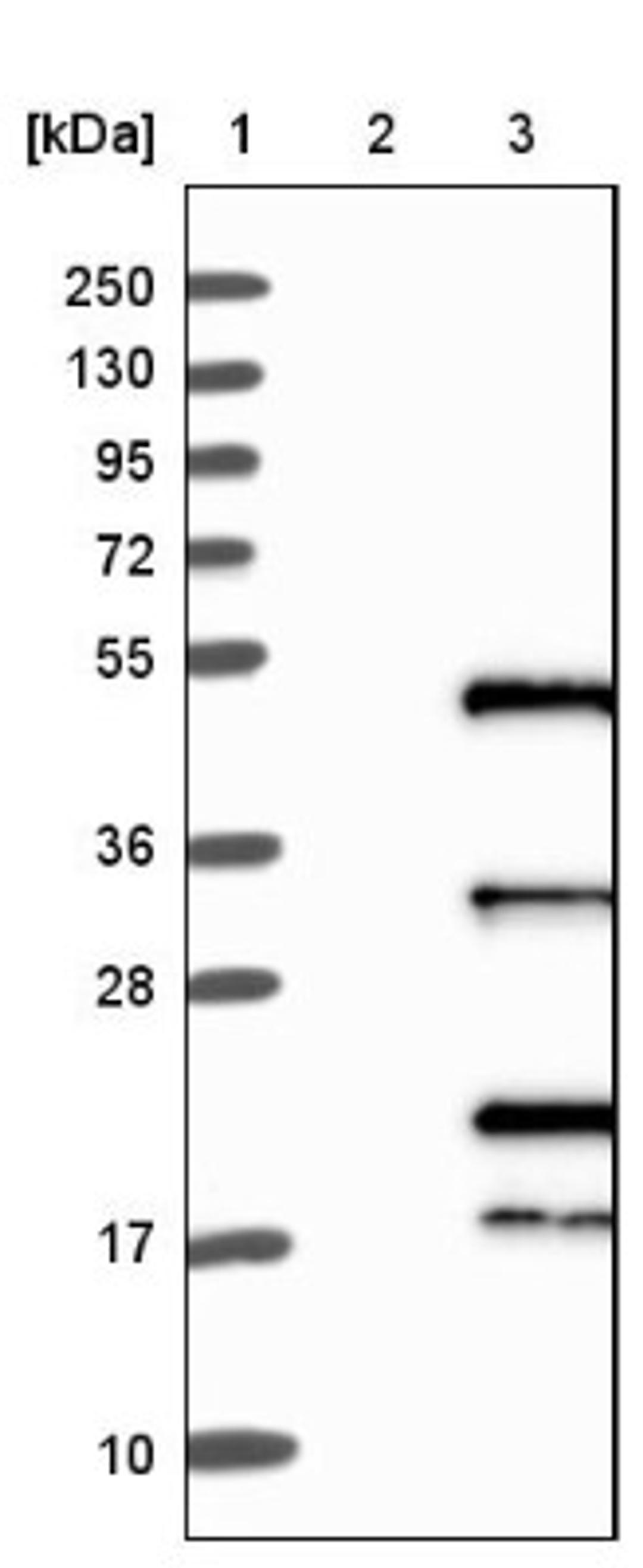 Western Blot: IRF2 Antibody [NBP1-89433] - Lane 1: Marker [kDa] 250, 130, 95, 72, 55, 36, 28, 17, 10<br/>Lane 2: Negative control (vector only transfected HEK293T lysate)<br/>Lane 3: Over-expression lysate (Co-expressed with a C-terminal myc-DDK tag (~3.1 kDa) in mammalian HEK293T cells, LY400800)