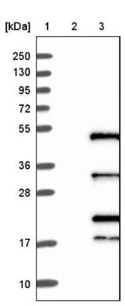 Western Blot: IRF2 Antibody [NBP1-89433] - Lane 1: Marker [kDa] 250, 130, 95, 72, 55, 36, 28, 17, 10<br/>Lane 2: Negative control (vector only transfected HEK293T lysate)<br/>Lane 3: Over-expression lysate (Co-expressed with a C-terminal myc-DDK tag (~3.1 kDa) in mammalian HEK293T cells, LY400800)