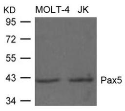 Western blot analysis of lysed extracts from MOLT-4 and JK cells using Pax5 Antibody.