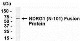 E coli-derived fusion protein as test antigen. Affinity-purified IgY dilution: 1:2000, Goat anti-IgY-HRP dilution: 1:1000. Colorimetric method for signal development.