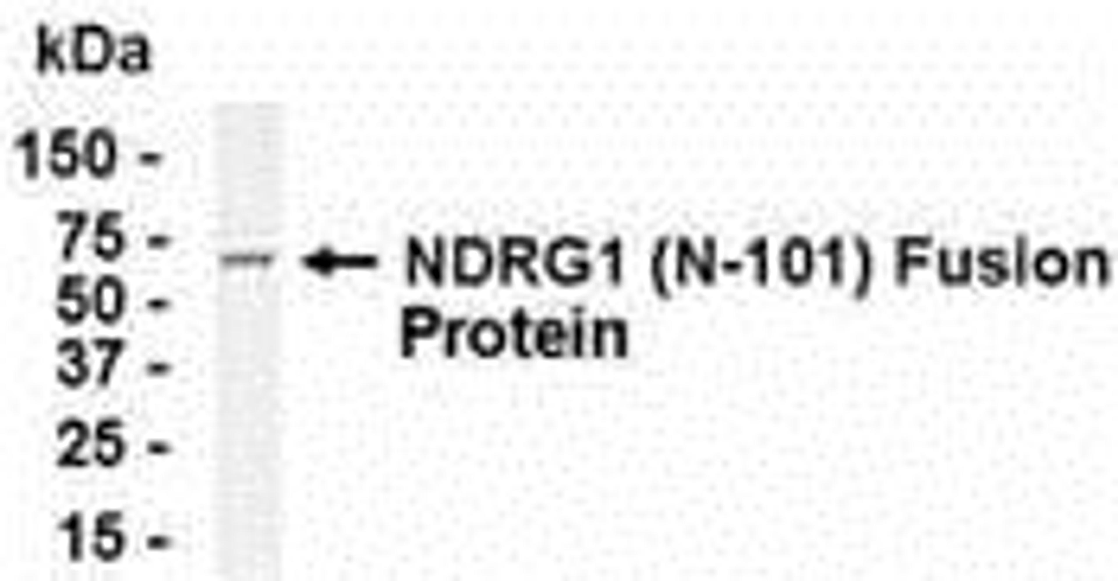 E coli-derived fusion protein as test antigen. Affinity-purified IgY dilution: 1:2000, Goat anti-IgY-HRP dilution: 1:1000. Colorimetric method for signal development.