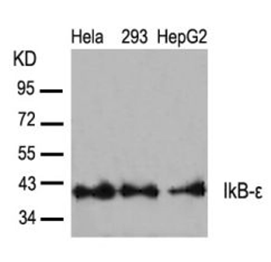 Western blot analysis of lysed extracts from HeLa, 293 and HepG2 cells using IkB-&#949; (Ab-22).