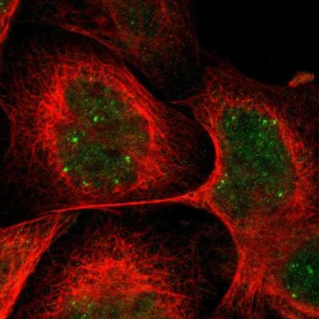 Immunocytochemistry/Immunofluorescence: CRCP Antibody [NBP1-84495] - Anaysis of human cell line A-431 shows positivity in nucleus. Antibody staining is shown in green.