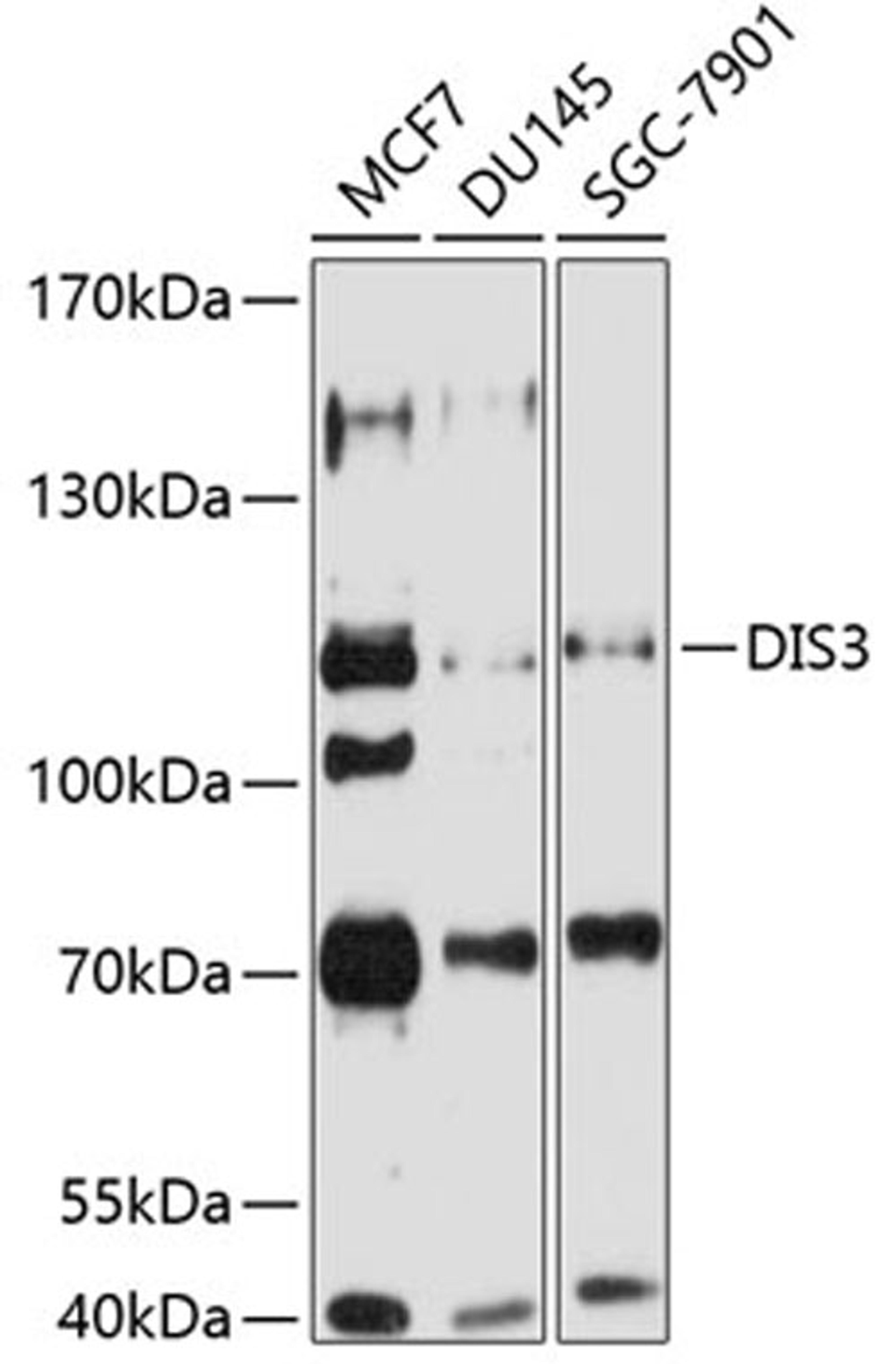 Western blot - DIS3 antibody (A8027)