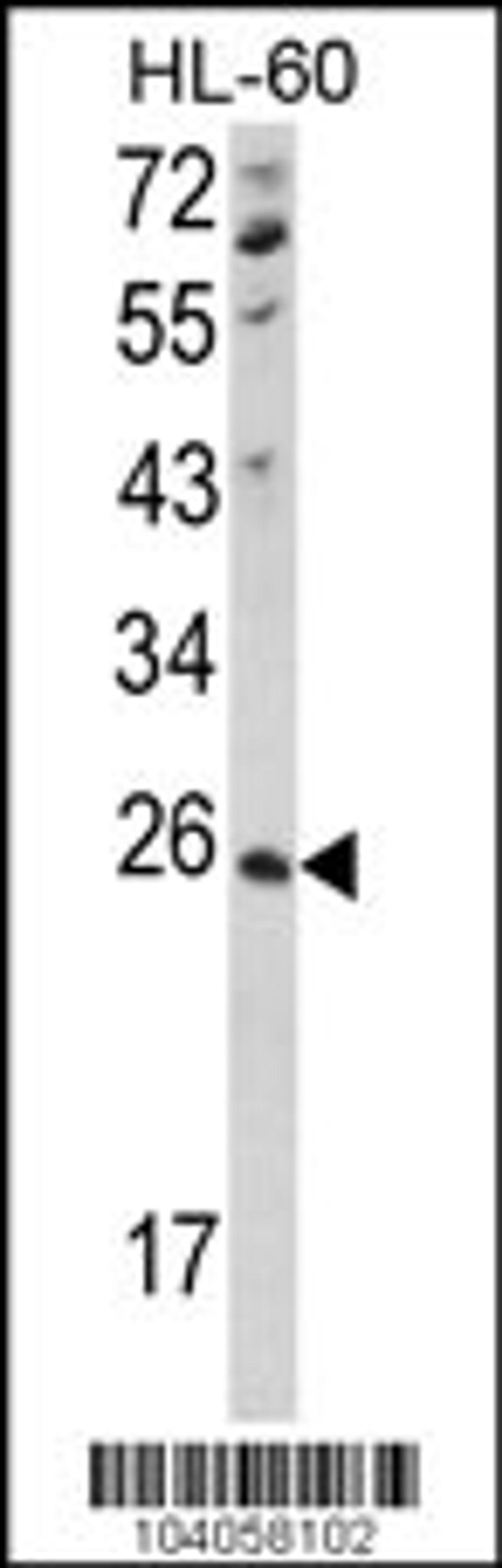 Western blot analysis of hNME4-V173 in HL-60 cell line lysates (35ug/lane)