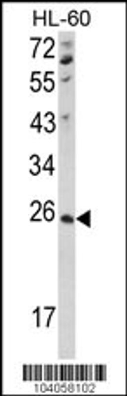 Western blot analysis of hNME4-V173 in HL-60 cell line lysates (35ug/lane)