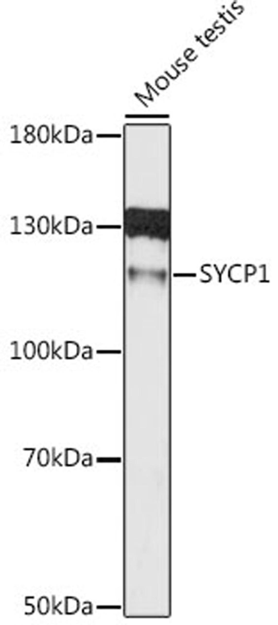 Western blot - SYCP1 antibody (A12139)