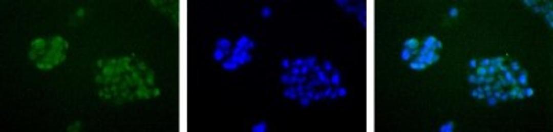 Immunocytochemistry/Immunofluorescence: APE Antibody [NB100-101] - Detection of APE1 (Green) in HepG2 cells using NB100-101. Nuclei (Blue) are counterstained with Hoechst 33258.