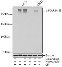 Western blot - Phospho-POLR2A-S5 Rabbit mAb (AP0997)