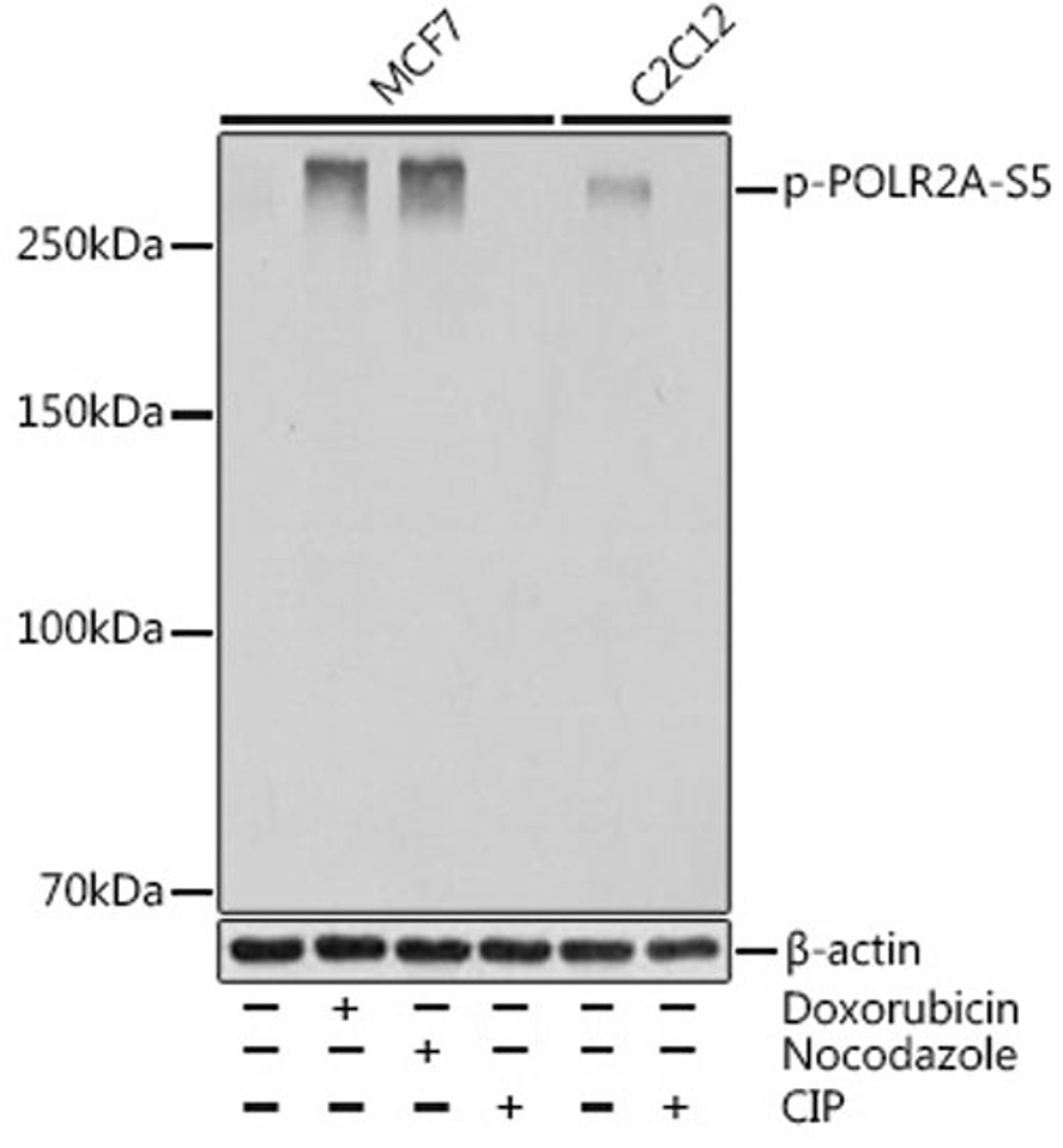 Western blot - Phospho-POLR2A-S5 Rabbit mAb (AP0997)