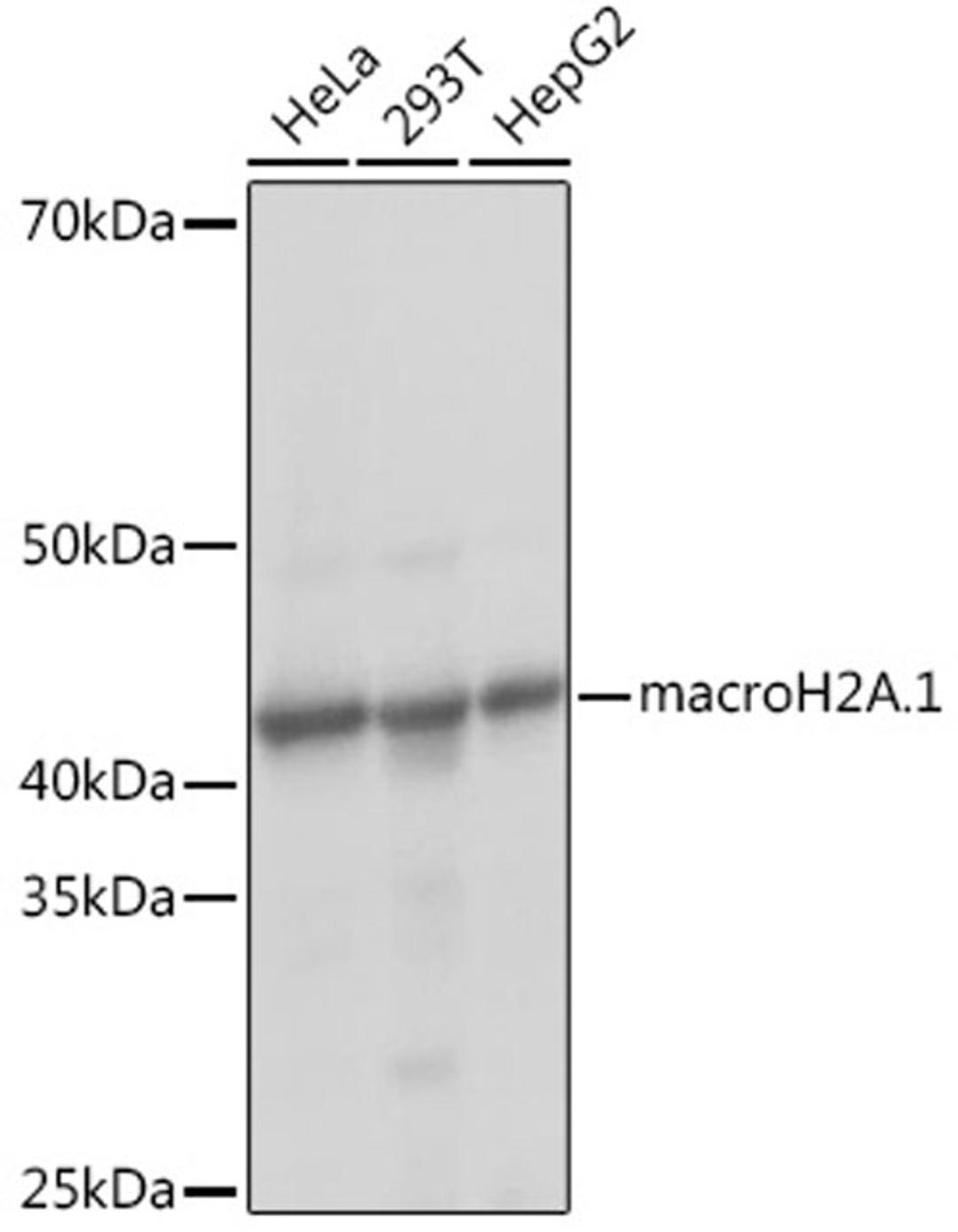 Western blot - macroH2A.1 Rabbit mAb (A9059)