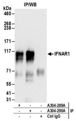 Detection of human IFNAR1 by western blot of immunoprecipitates.