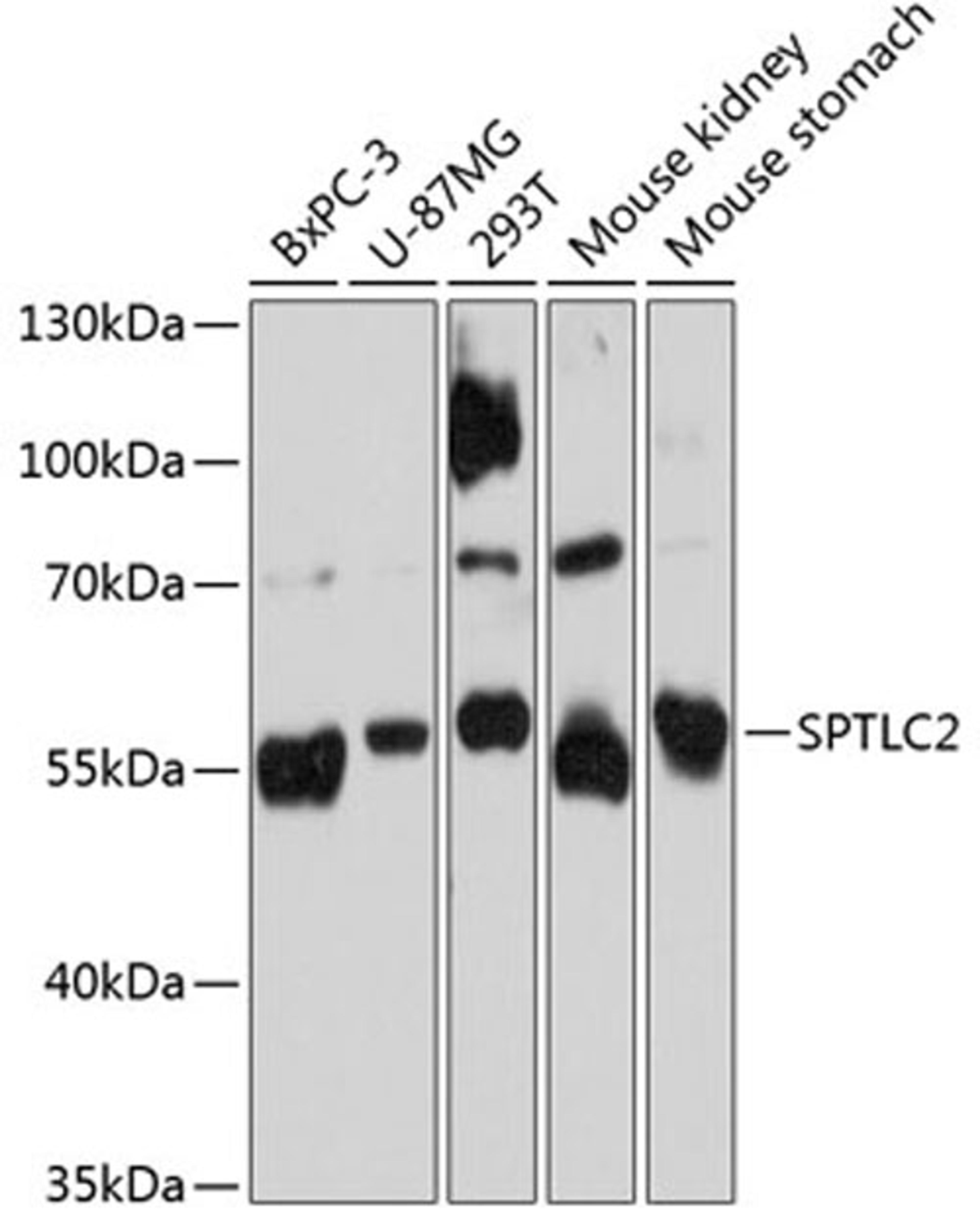 Western blot - SPTLC2 Antibody (A11716)