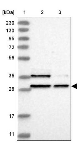 Western Blot: IER5 Antibody [NBP1-85935] - Lane 1: Marker [kDa] 230, 130, 95, 72, 56, 36, 28, 17, 11<br/>Lane 2: Human cell line RT-4<br/>Lane 3: Human cell line U-251MG sp