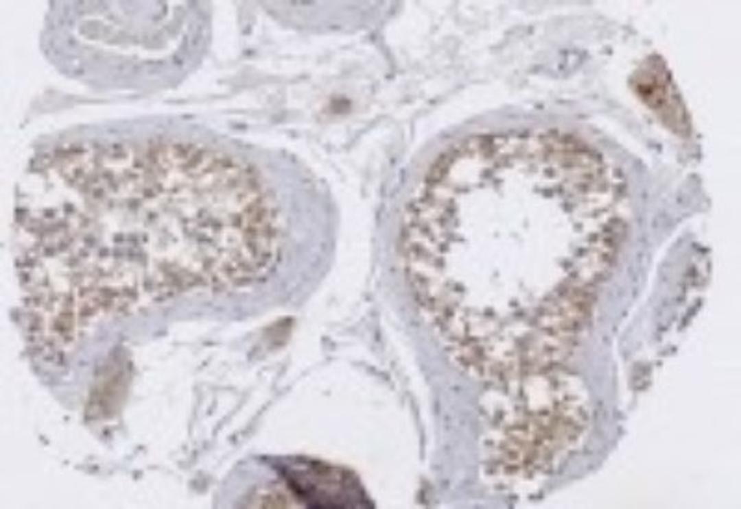 Immunohistochemistry-Paraffin: TRIM29 Antibody [NB120-22207] - Immunohistochemical staining with anti-TRIM29 antibody in normal testis tissue at 1:100 dilution.