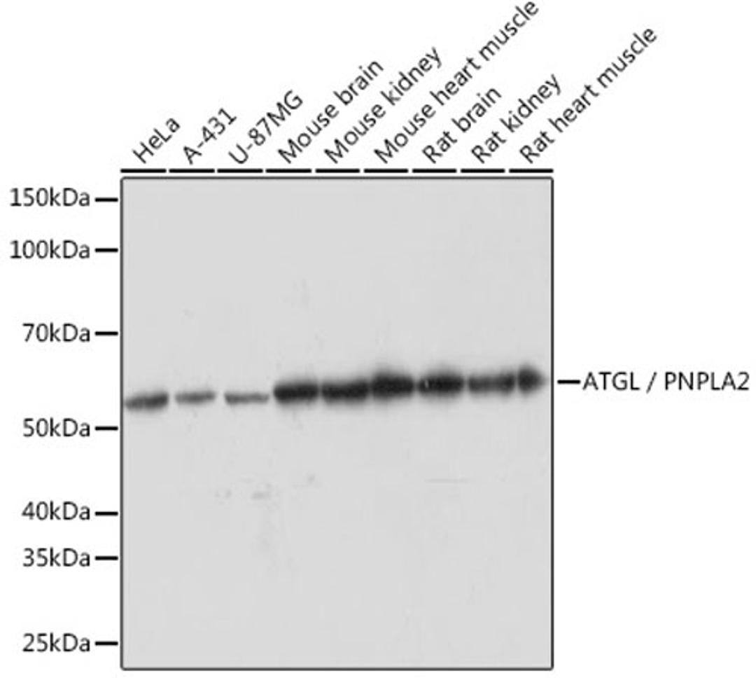 Western blot - ATGL / PNPLA2 Rabbit mAb (A5126)