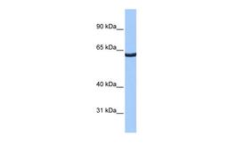 Antibody used in WB on Human HepG2 at 0.2-1 ug/ml.