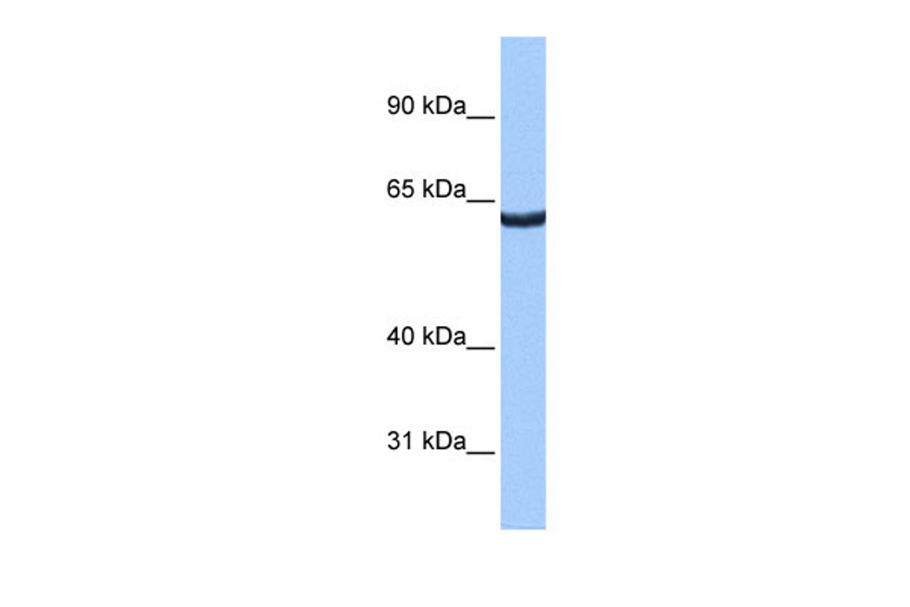 Antibody used in WB on Human HepG2 at 0.2-1 ug/ml.