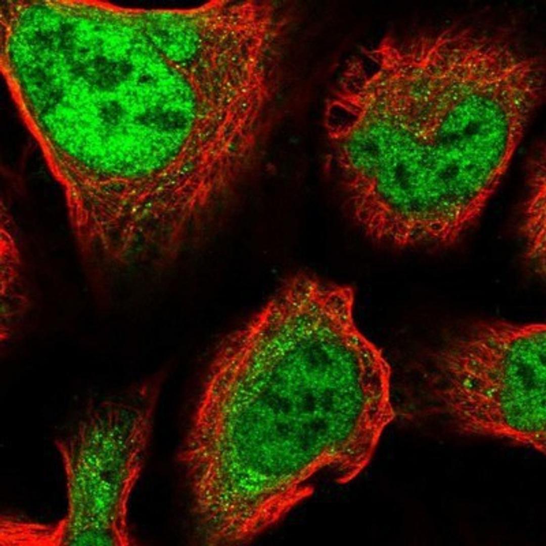 Immunocytochemistry/Immunofluorescence: ZNF281 Antibody [NBP2-13564] - Staining of human cell line U-2 OS shows positivity in nucleus but not nucleoli.